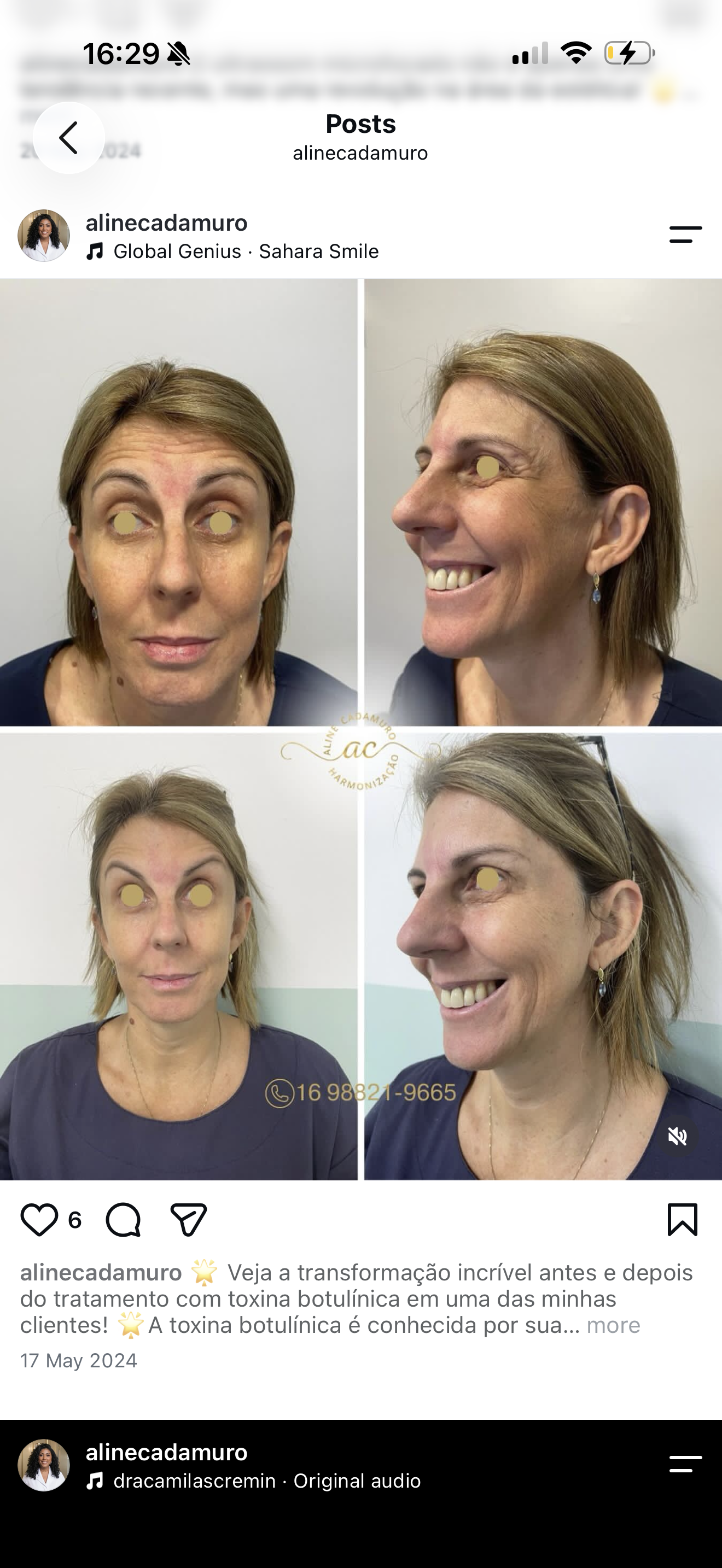 Antes e depois de expressão facial, na montagem original publicada pela Aline