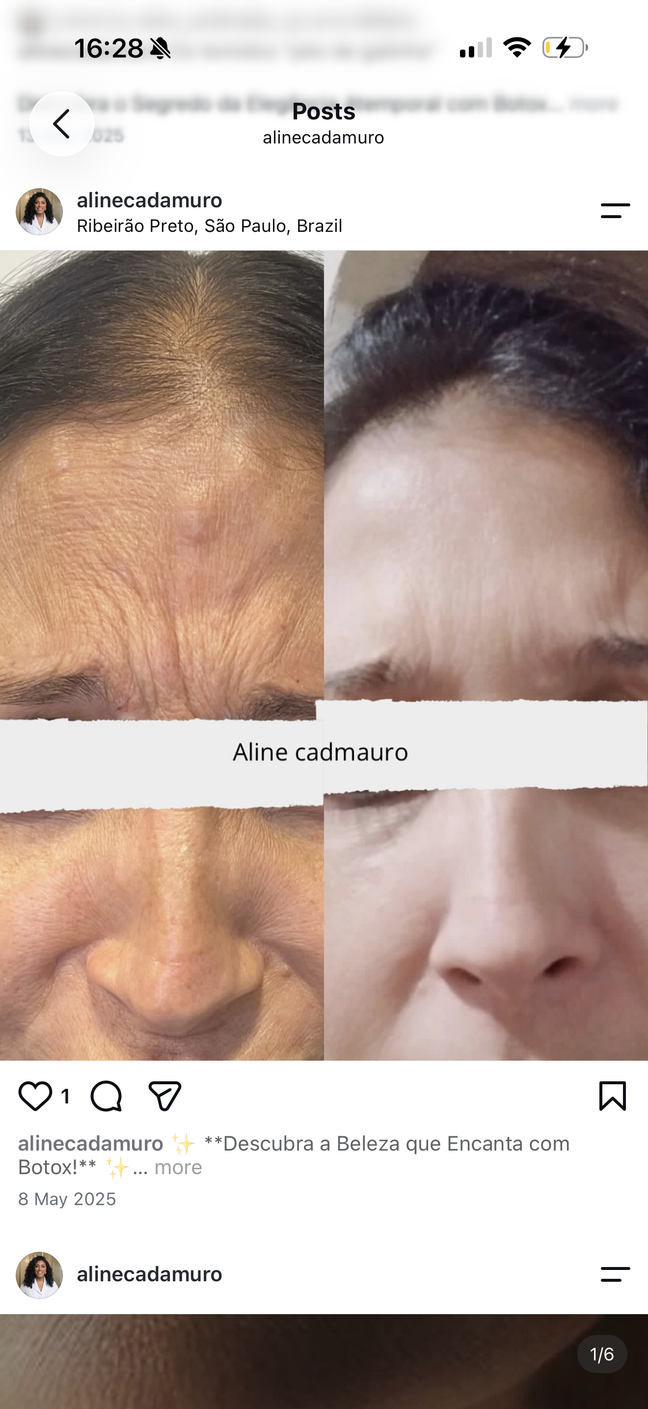 Antes e depois de linhas de expressão, na montagem original publicada pela Aline